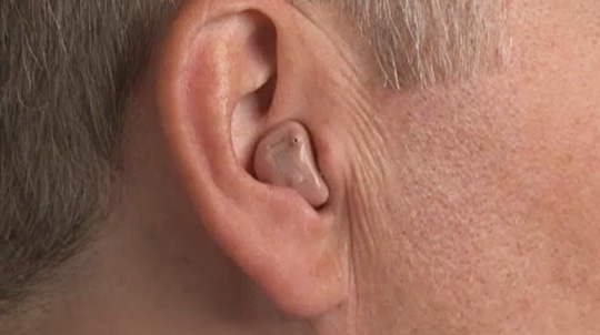 Inserting the Device